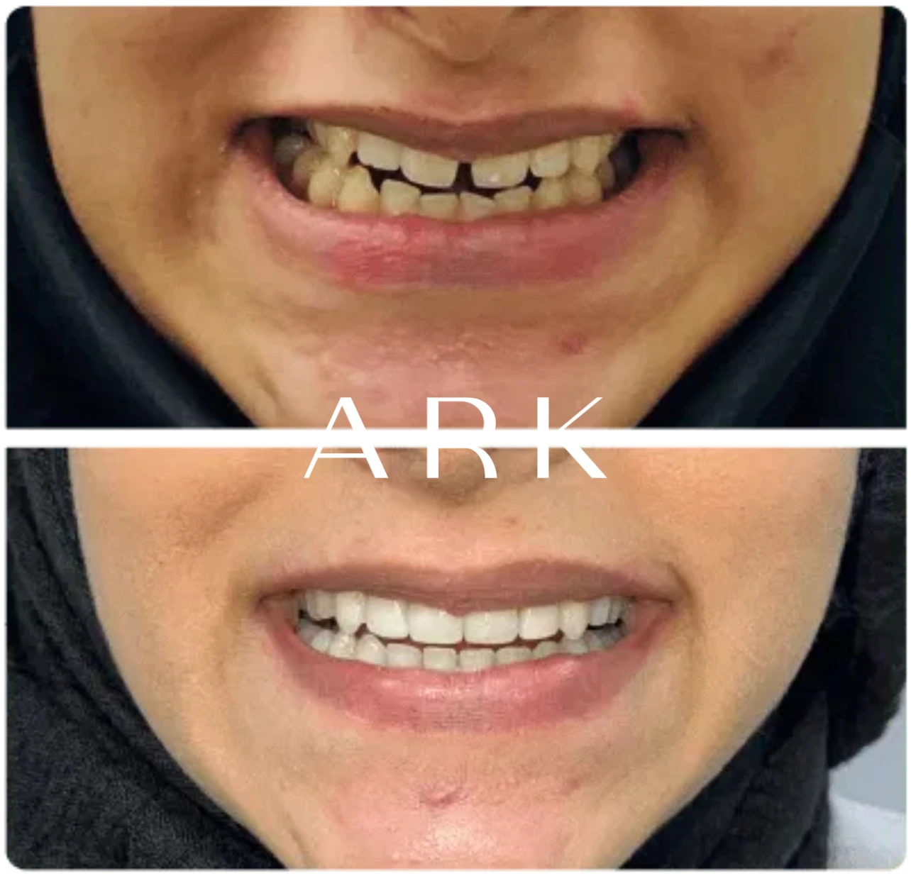 Orthodontics