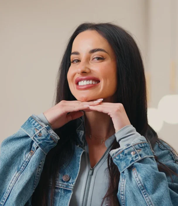 composite bonding perfect smile