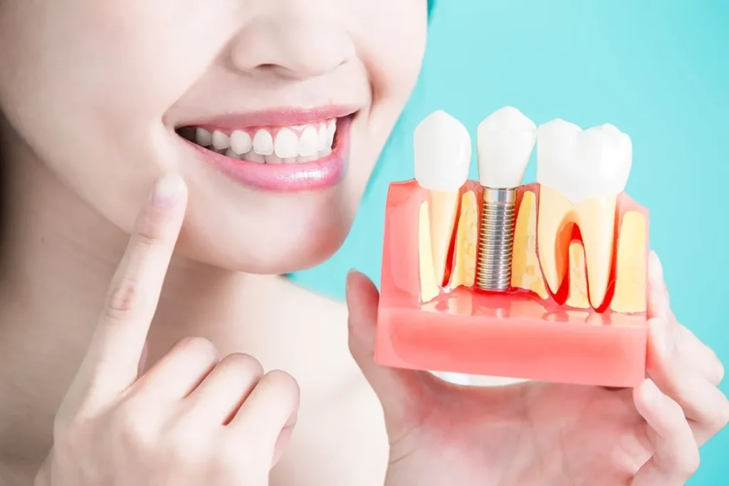 dental implants yorkshire
