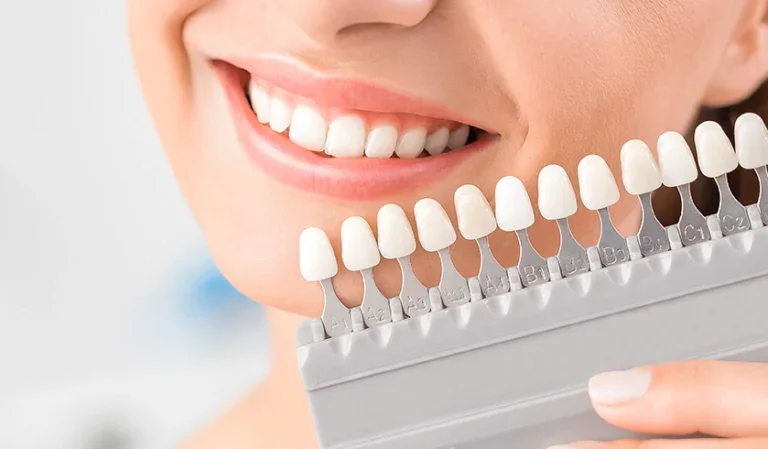Professional teeth whitening at ARK Dentistry in yorkshire