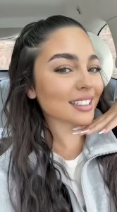 glo clear aligners