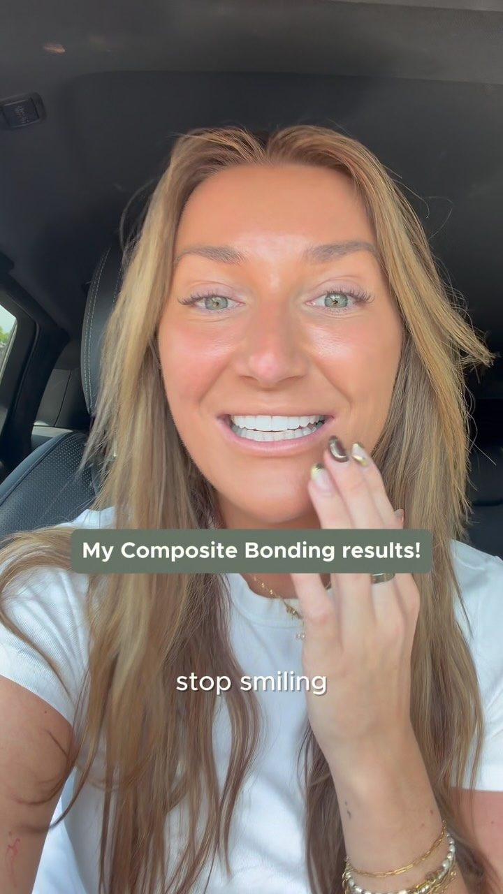 Nothing beats hearing it from the patient themselves 🤍

Alicia shares her thoughts after her Composite Bonding treatment, from how she felt before to the confidence she has now.

Thinking about transforming your smile? Book a consultation with our team today ✨

#ArkDentistry #CompositeBonding #SmileTransformation #SmileConfidence