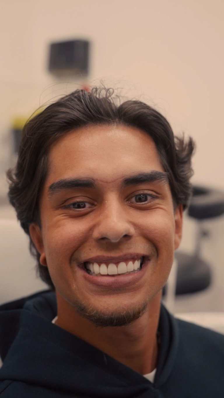 Your dream smile could be just one appointment away 🦷✨

Composite Bonding is a quick, minimally invasive treatment designed to enhance the colour, shape, and overall appearance of your teeth, creating a beautifully natural-looking smile. 

Watch the transformation from start to finish and see how small changes can make a big difference 🤩

Ready for your smile transformation? Book in for your free consultation today! 

#ArkDentistry #CompositeBonding #SmileTransformation