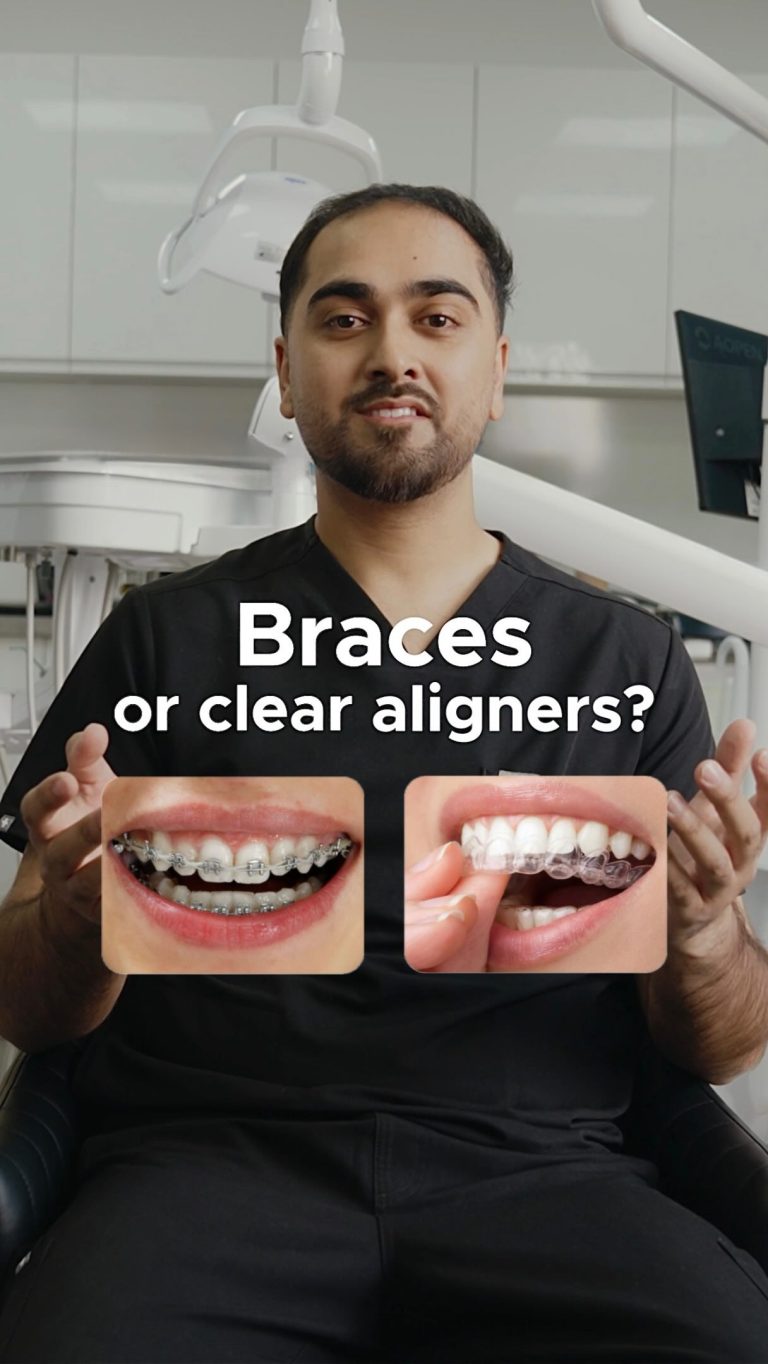 Fixed braces or clear aligners? 🦷🤔

When it comes to straightening your smile, there isn’t a one-size-fits all approach.

At Ark Dentistry, we offer both fixed braces and @gloaligners so you can explore the option that best suits your smile, lifestyle and treatment needs. 

Two options. One goal: a smile you’ll love 🙌✨

#ArkDentistry #ClearAligners #FixedBraces #SmileMakeover