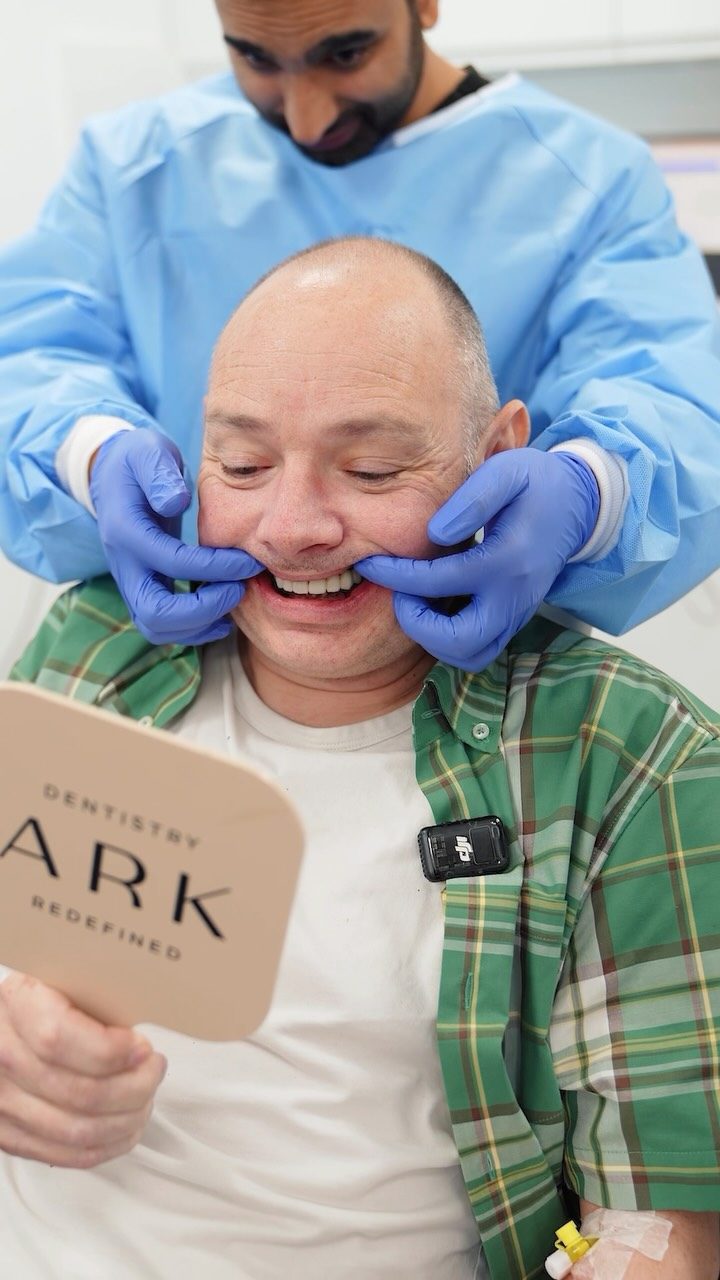 Michael’s transformation was about so much more than a new smile, it was about regaining his confidence and getting his life back 🥹✨

Choosing Dental Implants was a life changing step towards restoring his smile, improving his quality of life and helping him feel like himself again.

From being able to eat comfortably, to smiling without hesitation, the impact this transformation has had has been incredible 🤍

If you’re struggling with your smile and it’s affecting your confidence, we’re here to help you take the first step. Book your consultation today! 🦷

#ArkDentistry #DentalImplants #SmileTransformation #Confidence