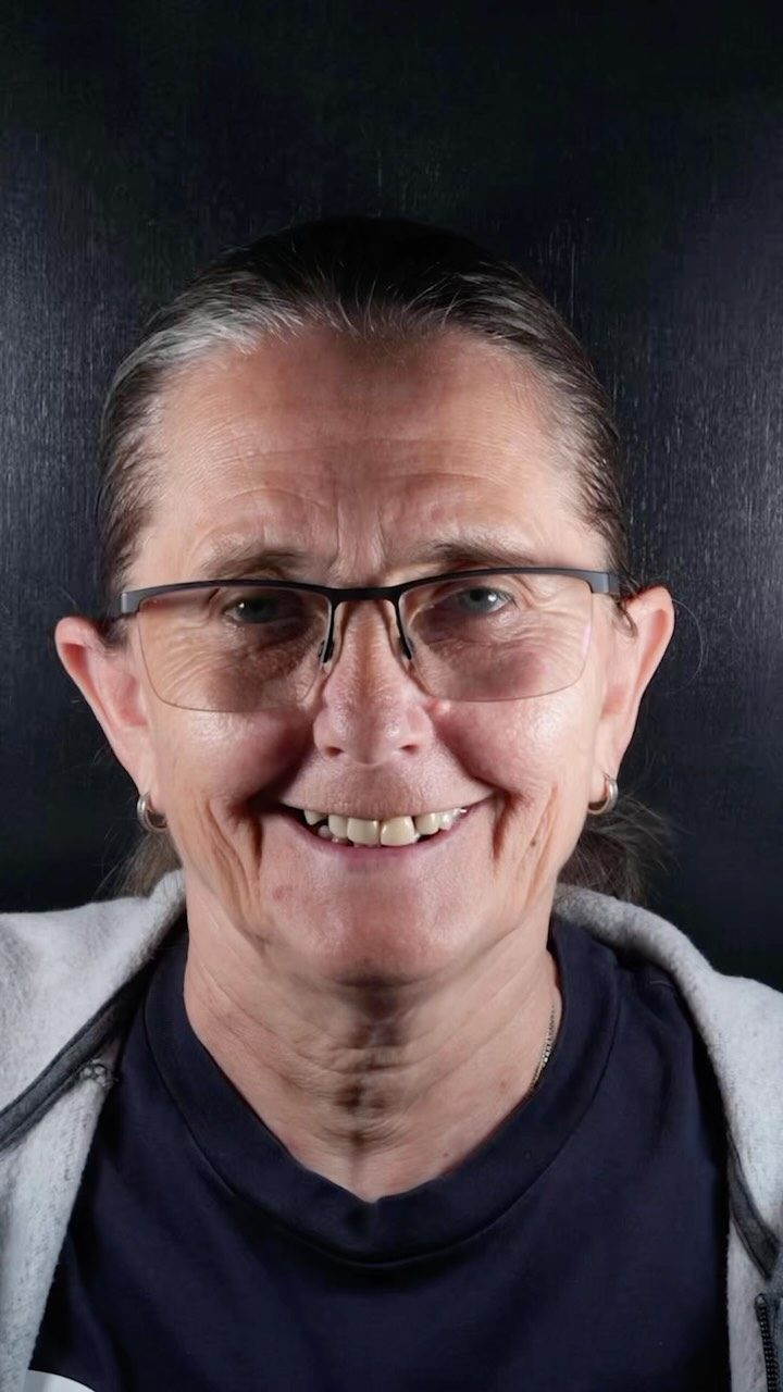 Tracey’s full smile transformation is here! 🤩✨

After beginning her Dental Implant journey with Ark, Tracey has achieved a smile she can feel more confident in 🦷

From where she started to her final result, the transformation is amazing! 

If you’re in a similar position to Tracey and thinking about your own smile transformation, drop us a DM! 💬

#ArkDentistry #DentalImplants #SmileJourney
